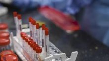 Comment le Rwanda parvient à bloquer l’importation de cas de Covid-19 dans le pays