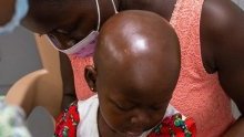 Diagnostic précoce du cancer chez l’enfant : l’exemple du Sénégal