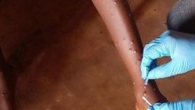 Mpox : l’OMS approuve le premier test de diagnostic pour une utilisation en situation d’urgence